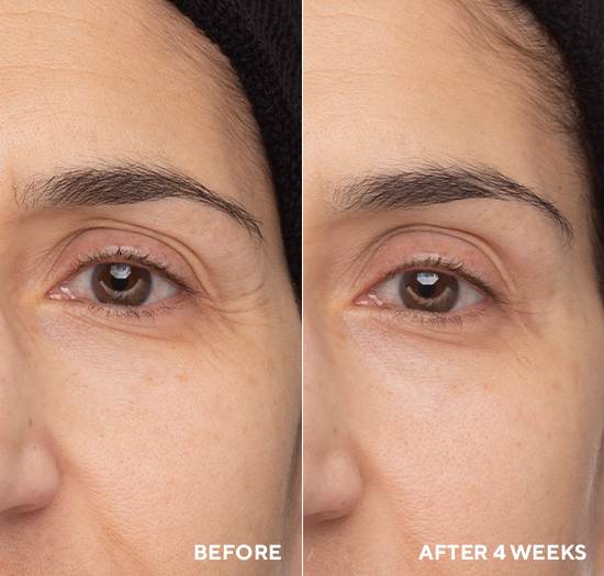 Retinol Eye Renewal Lifting & Firming Eye Balm | Retinol | LOSHEN & CREM