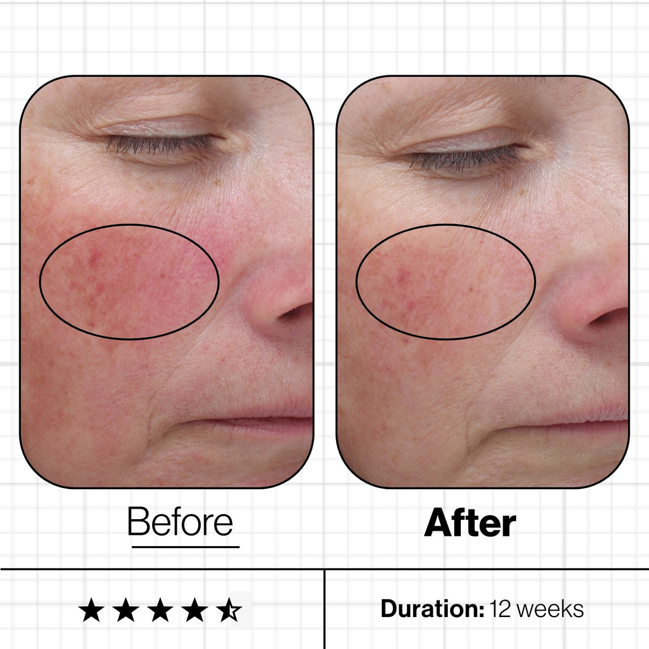 Advanced Nutrition Programme Skin Even IQ