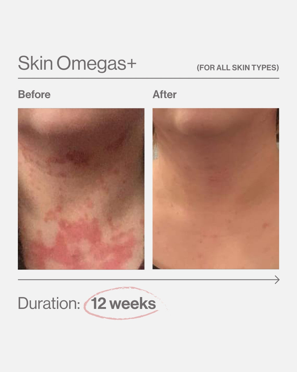 Advanced Nutrition Programme Skin Omegas+