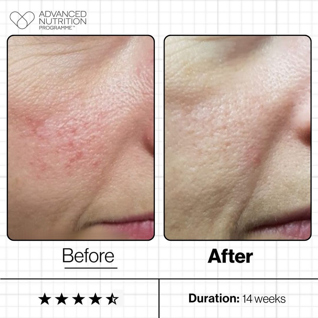 Advanced Nutrition Programme Skin Youth Synergy Set