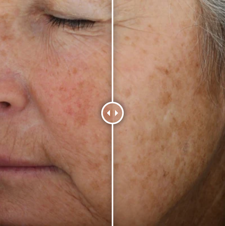 Alastin A-LUMINATE Brightening Serum™