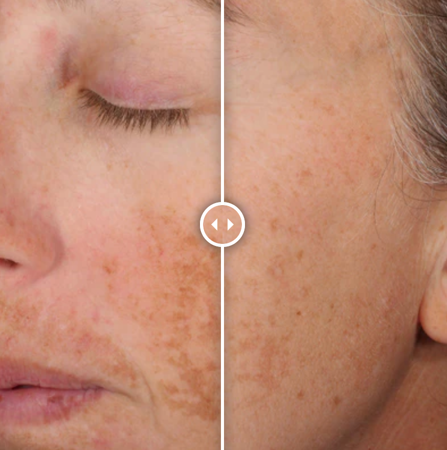 Alastin A-LUMINATE Brightening Serum™