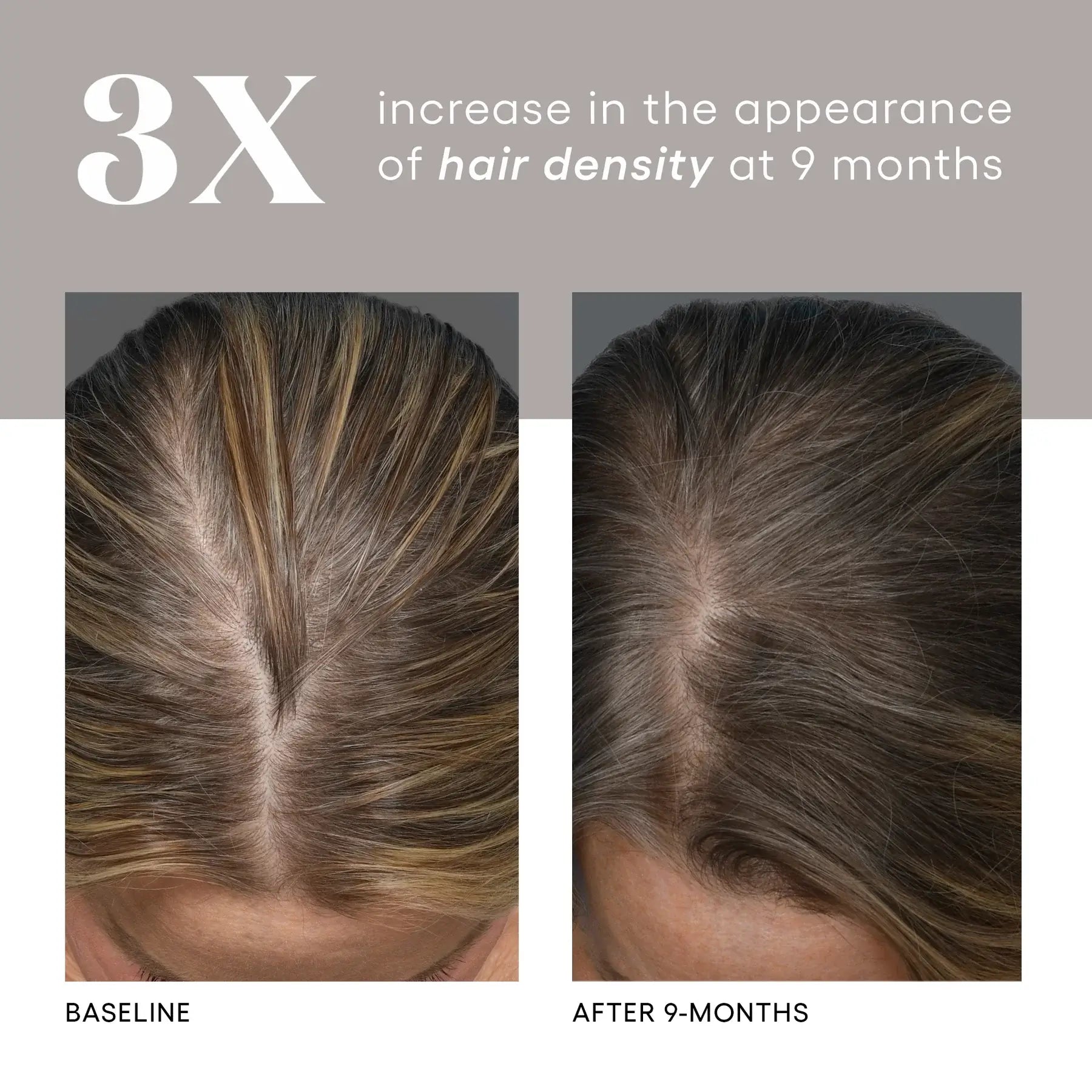 (Plated)™ Hair Serum | Hair - Growth solution | LOSHEN & CREM