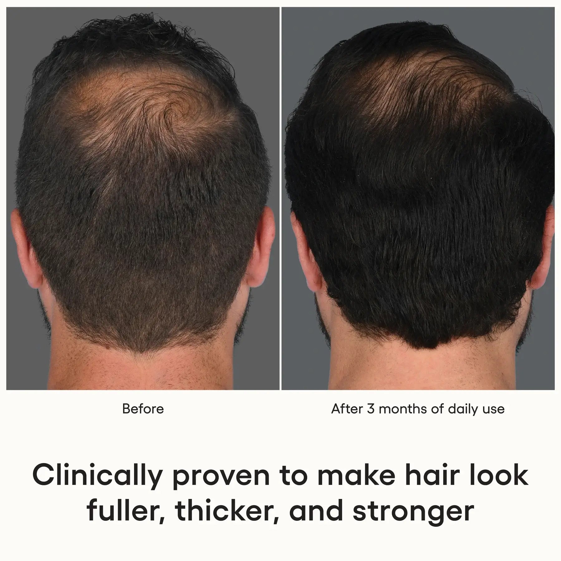 (Plated)™ Hair Serum | Hair - Growth solution | LOSHEN & CREM
