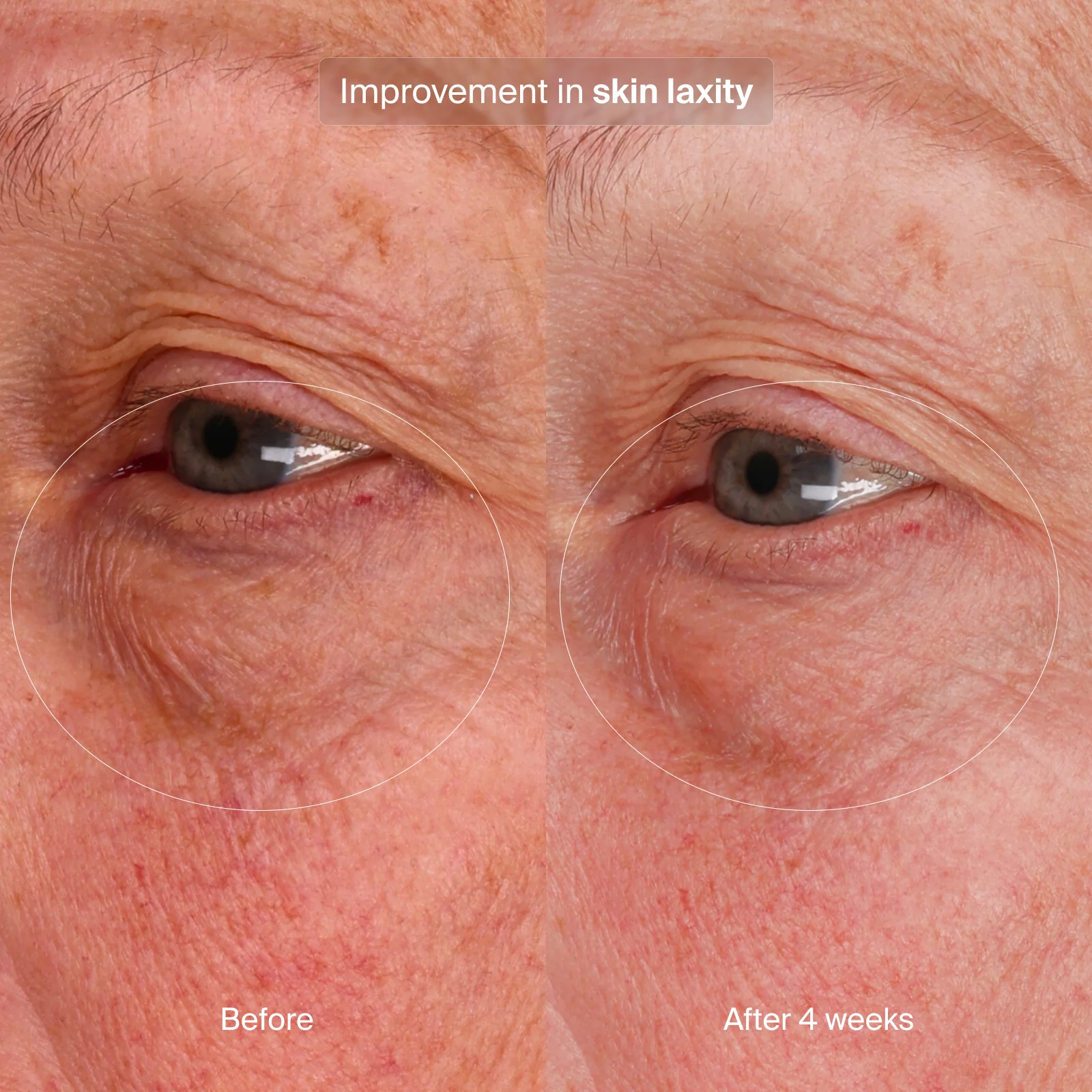 Pavise Bioadaptive Stress Repair | Serum - Advanced Regenerative | LOSHEN & CREM