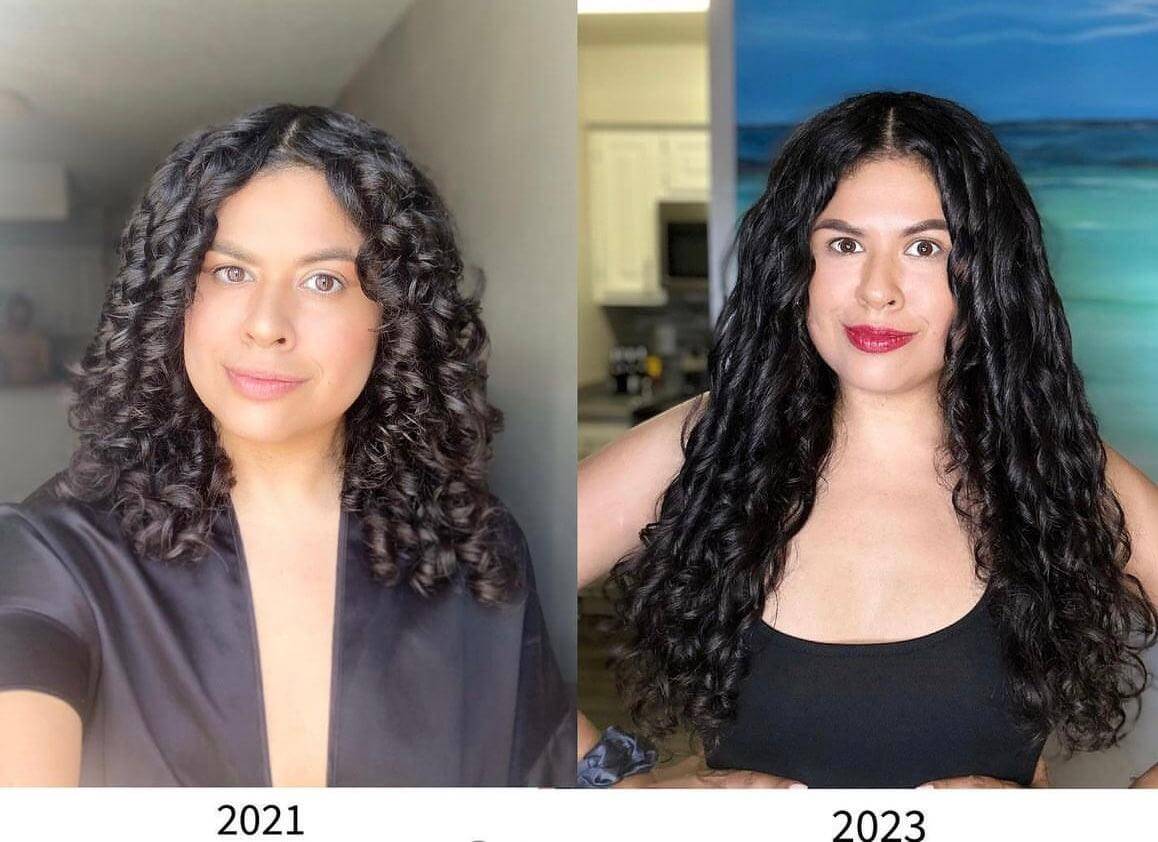 Bur Bur Growing Season Hair Oil - Burdock Hair Growth Treatment | Hair - Growth solution | LOSHEN & CREM