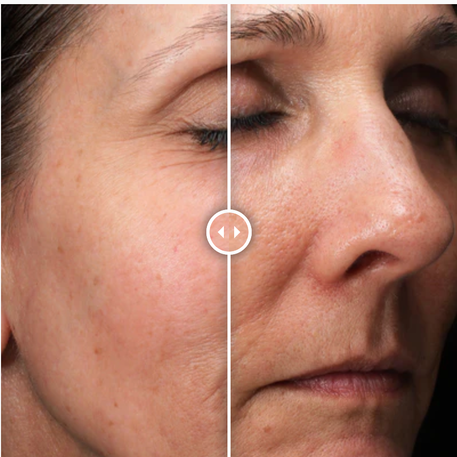 Alastin C-RADICAL Defense Antioxidant Serum