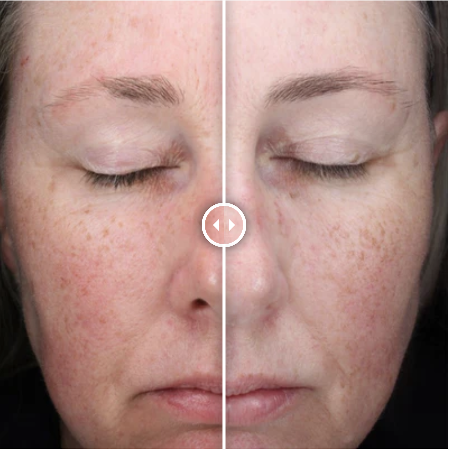 Alastin C-RADICAL Defense Antioxidant Serum