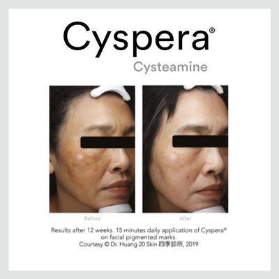 Cyspera® Intensive™
