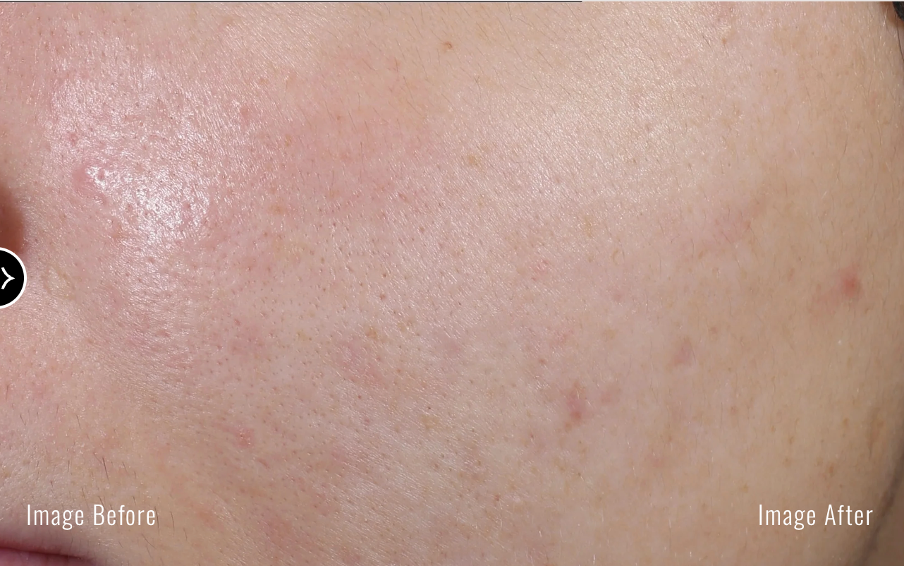 Sérum anti-imperfections DUAL +