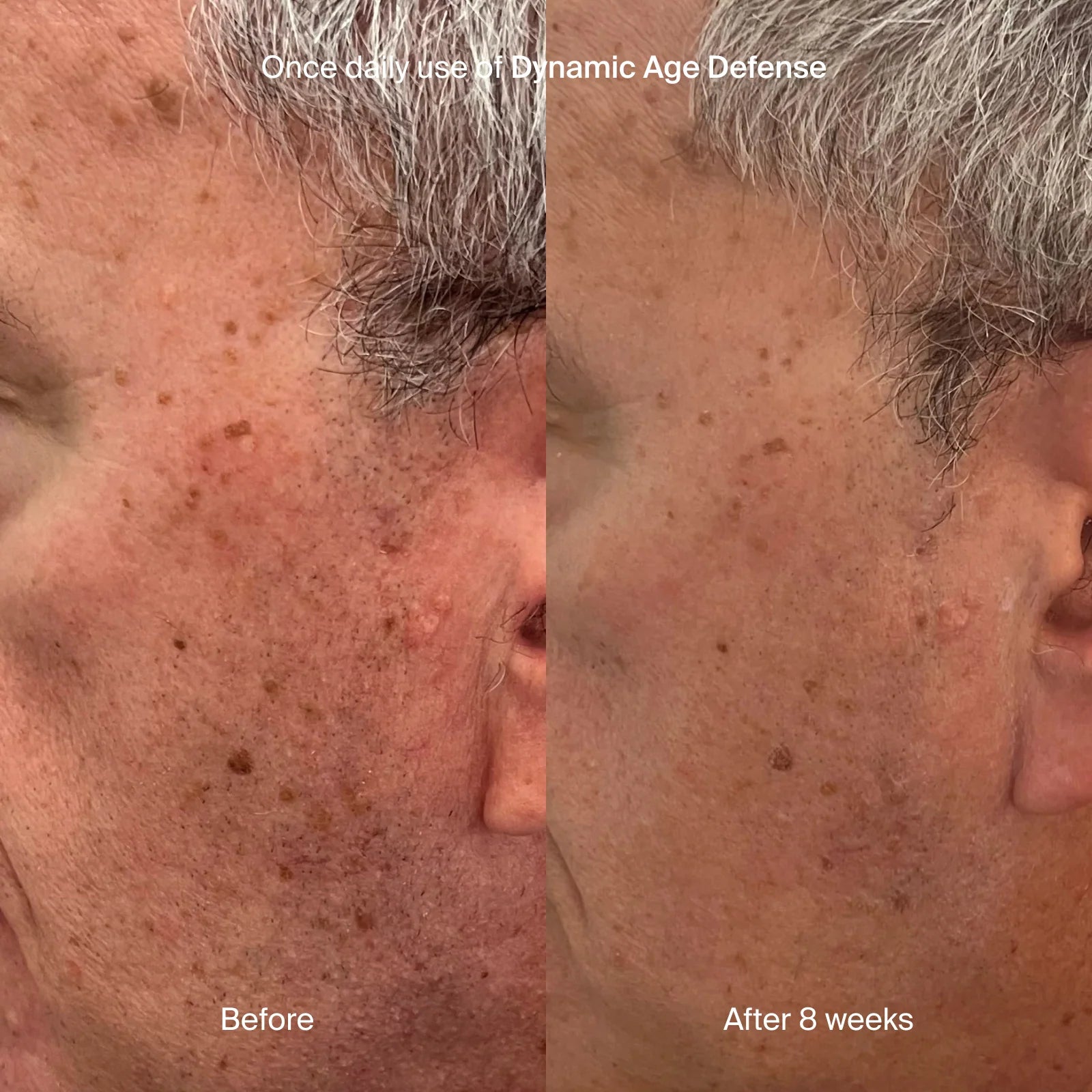 Pavise Dynamic Age Defense | Cream - Hyperpigmentation | LOSHEN & CREM