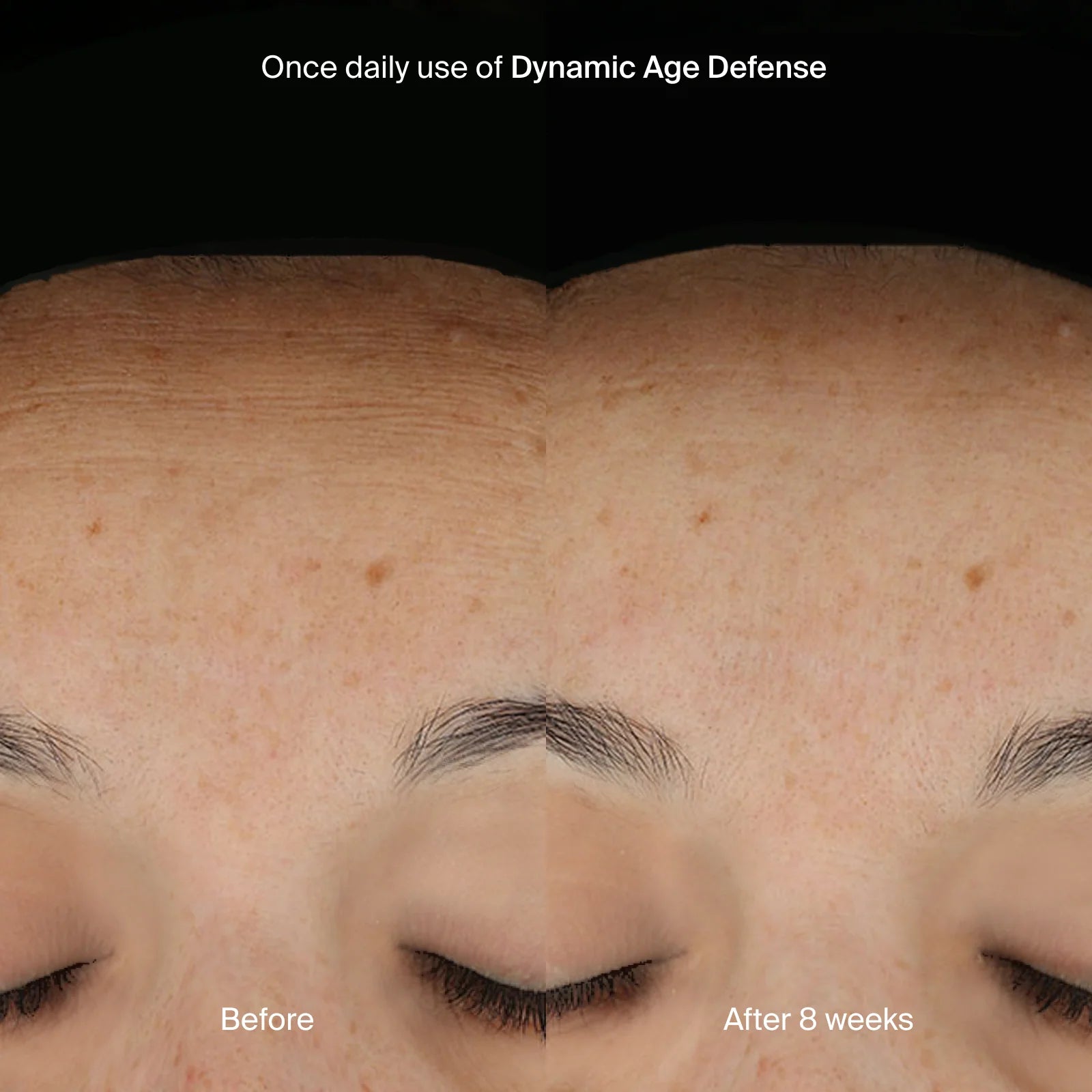 Pavise Dynamic Age Defense | Cream - Hyperpigmentation | LOSHEN & CREM