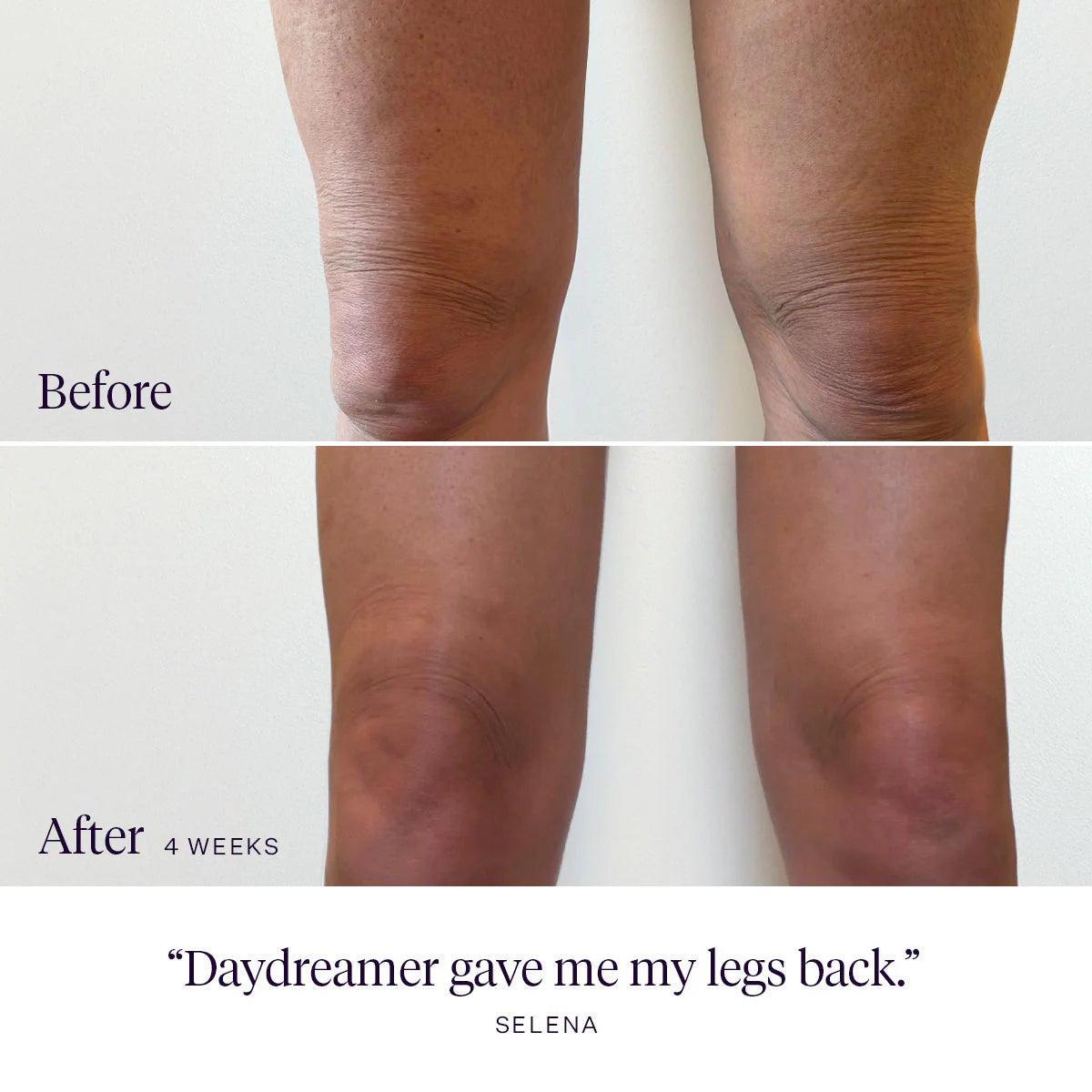 Daydreamer Firming Body Serum | Body - Serum | LOSHEN & CREM