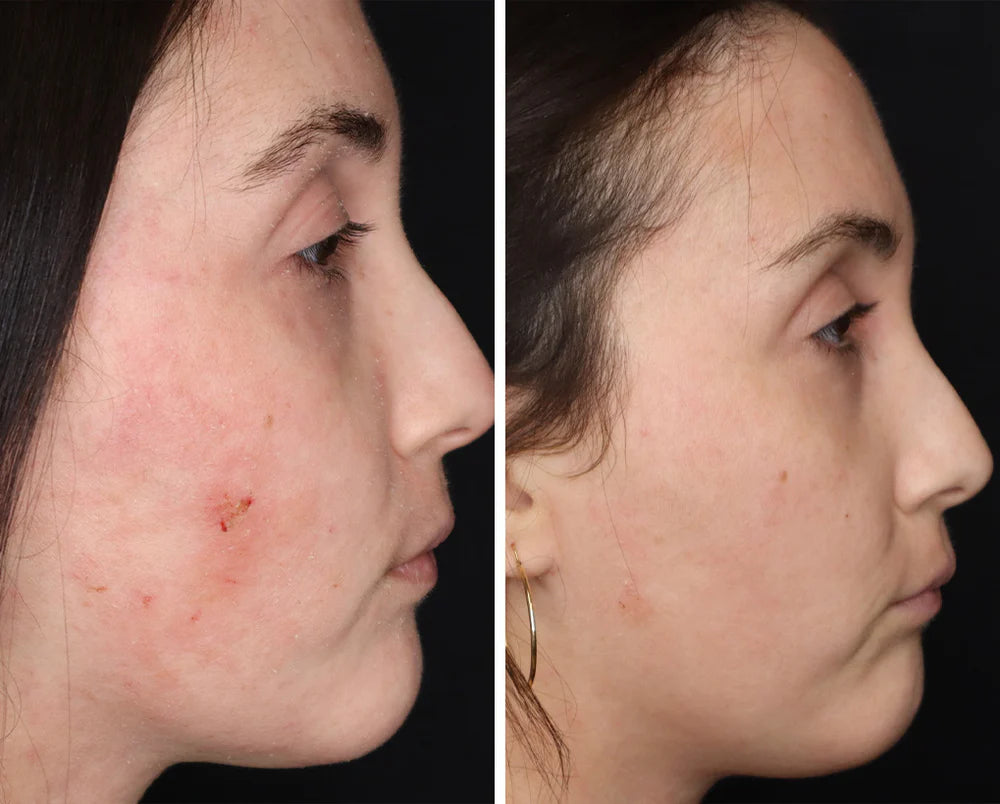 Derma Elastin™ - Firming gel | Healthy aging serum | LOSHEN & CREM