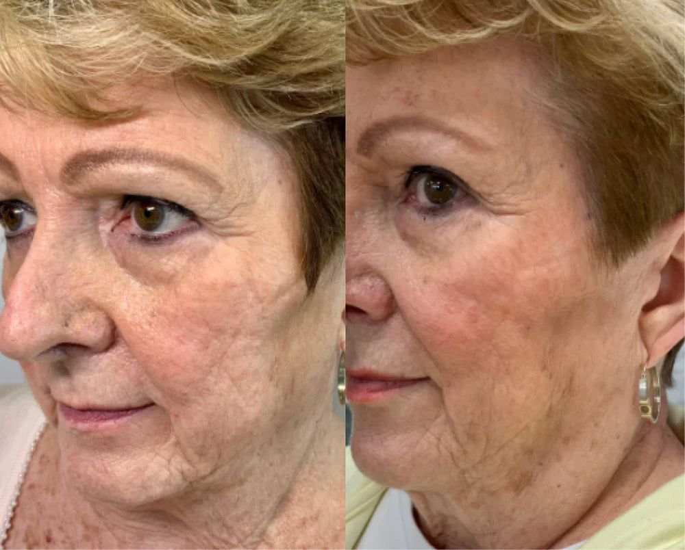 Derma Collagen™ regenerative gel | Healthy aging serum | LOSHEN & CREM