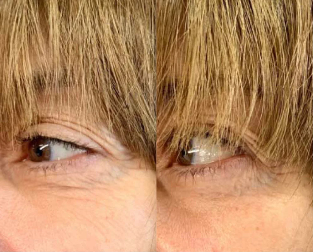 Derma Collagen™ regenerative gel | Healthy aging serum | LOSHEN & CREM