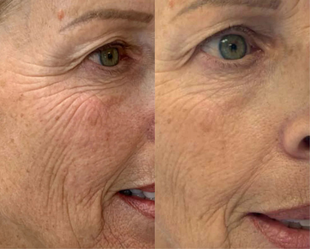 Derma Collagen™ regenerative gel | Healthy aging serum | LOSHEN & CREM