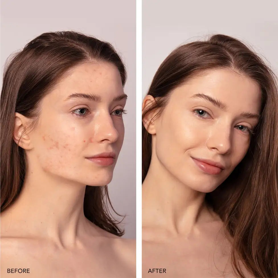 FOREO ESPADA™ 2 plus | Tools - LED device | LOSHEN & CREM