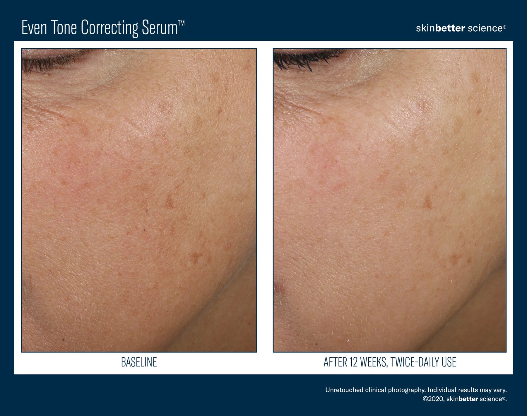 Even Tone Correcting Serum | Brightening serum | LOSHEN & CREM