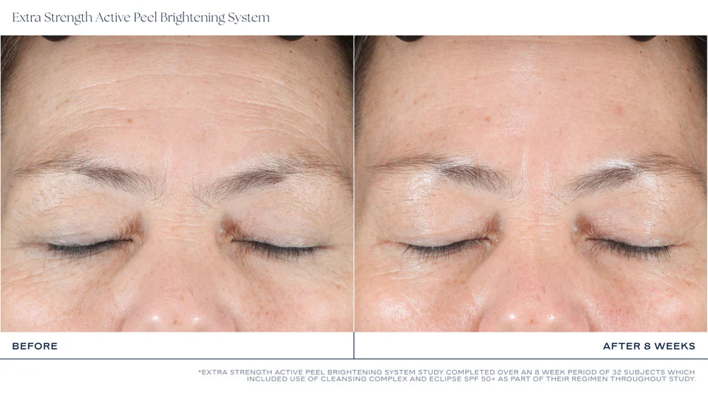 GWP iS Clinical Extra Strength Active Peel Brightening System (one pad) | GWP | LOSHEN & CREM