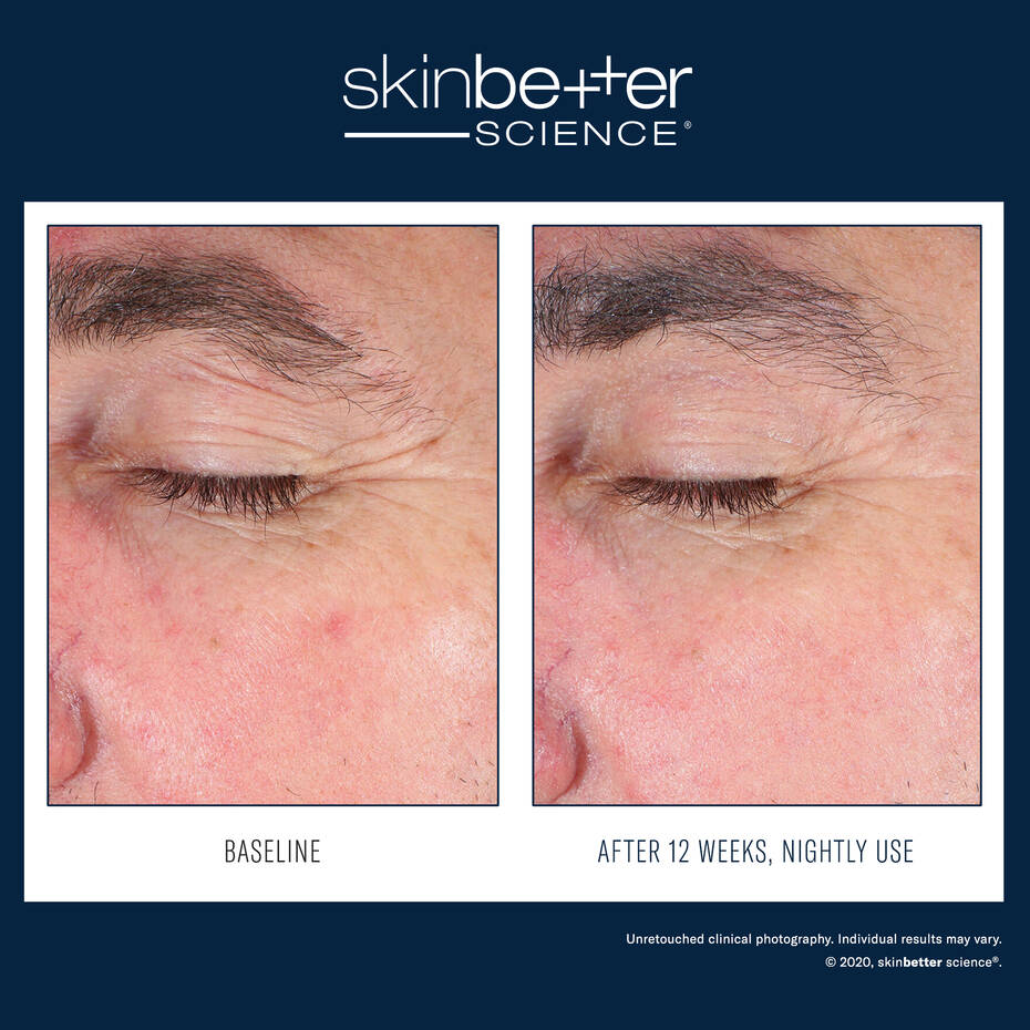 Eyemax Alpharet Overnight Cream | Retinol | LOSHEN & CREM