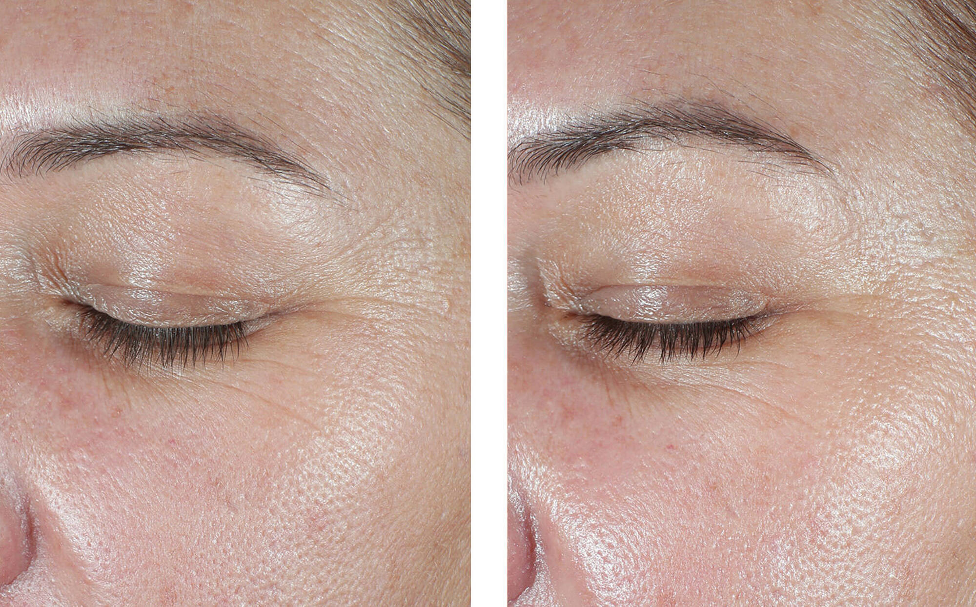 Eyemax Alpharet Overnight Cream | Retinol | LOSHEN & CREM