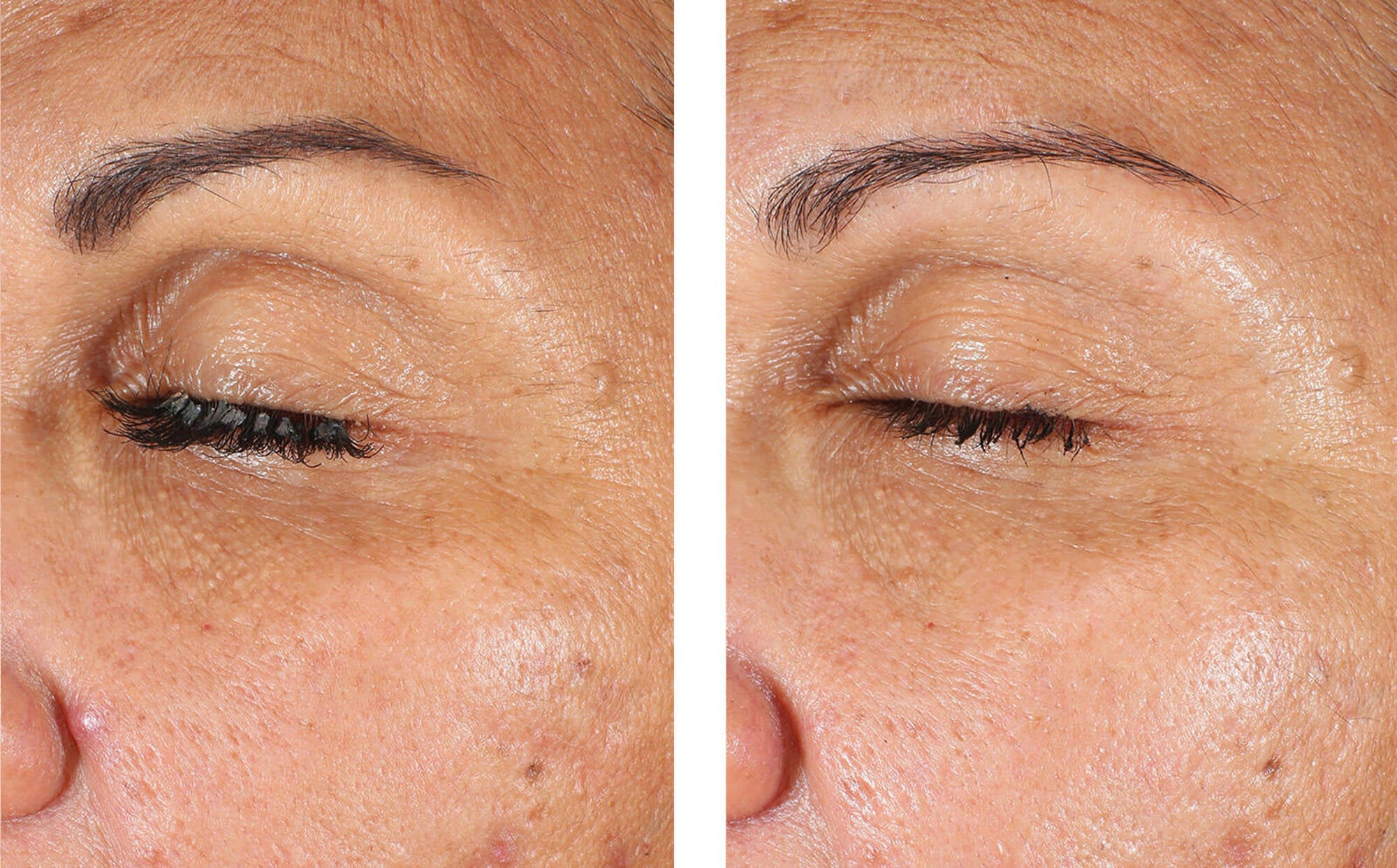 Eyemax Alpharet Overnight Cream | Retinol | LOSHEN & CREM