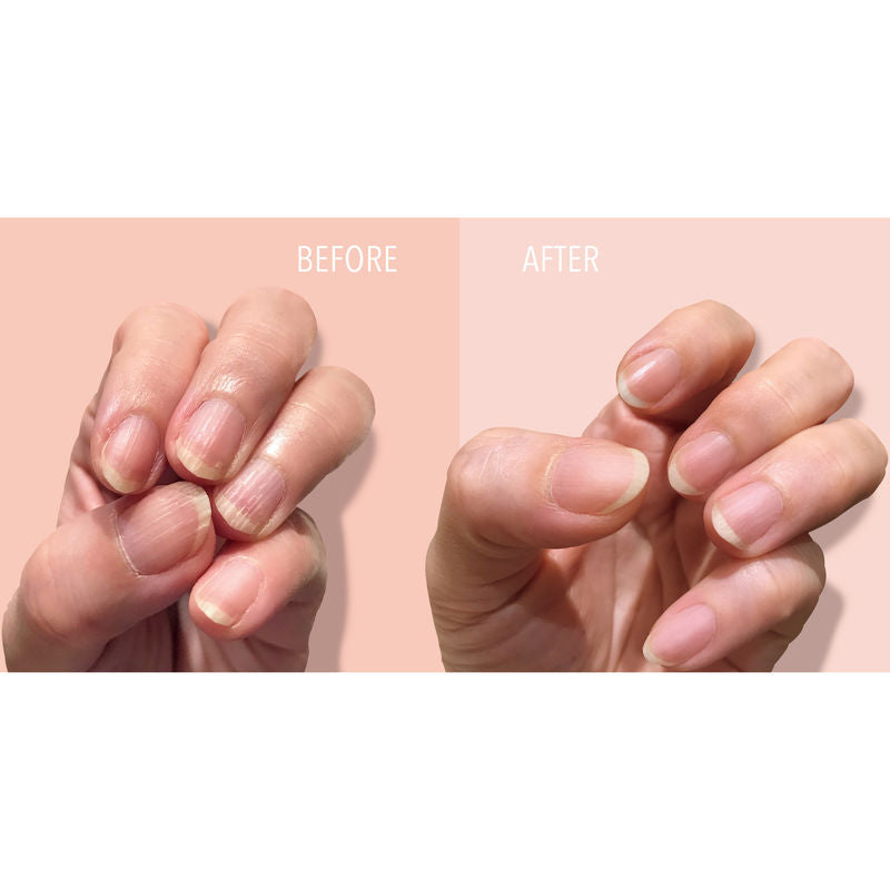 FORTIFYING RIDGE FILLER | Nail hardener | LOSHEN & CREM
