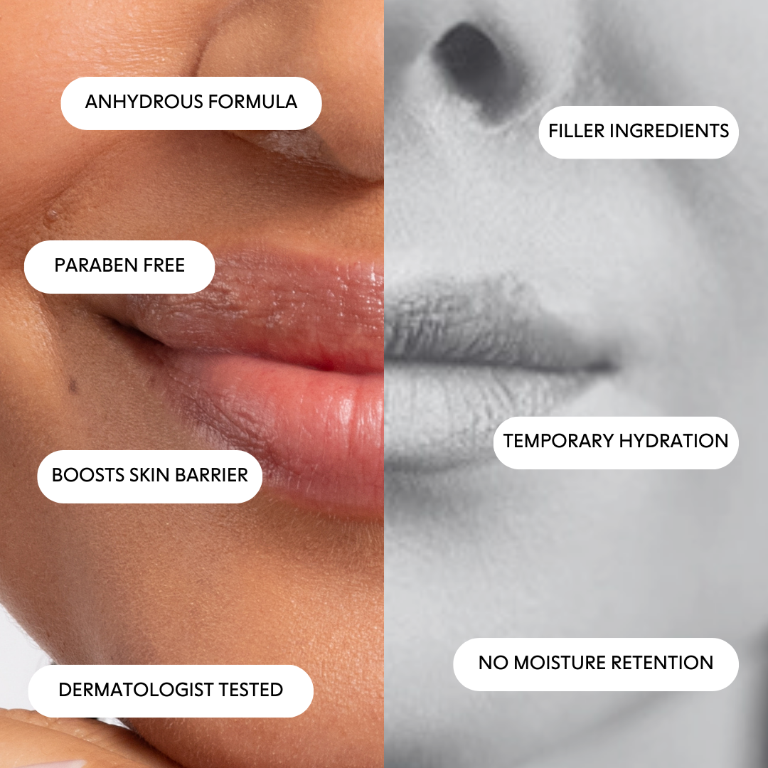 Fresh Peel - Mini Lip Mask | Lip mask | LOSHEN & CREM