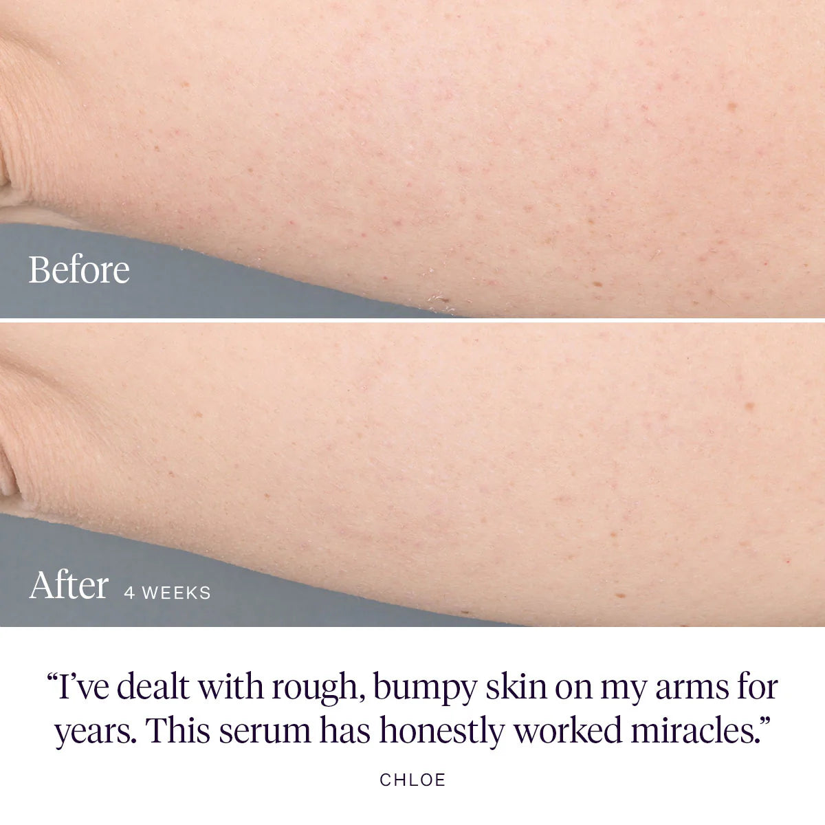 Kaleidoscope Smoothing Body Serum | Body - Serum | LOSHEN & CREM
