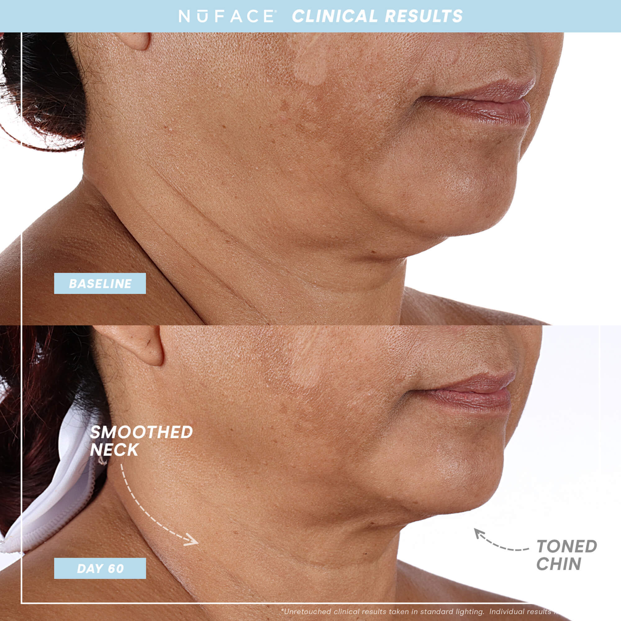 NuFACE® TRINITY+ PRO Complete Set | Microcurrent | LOSHEN & CREM