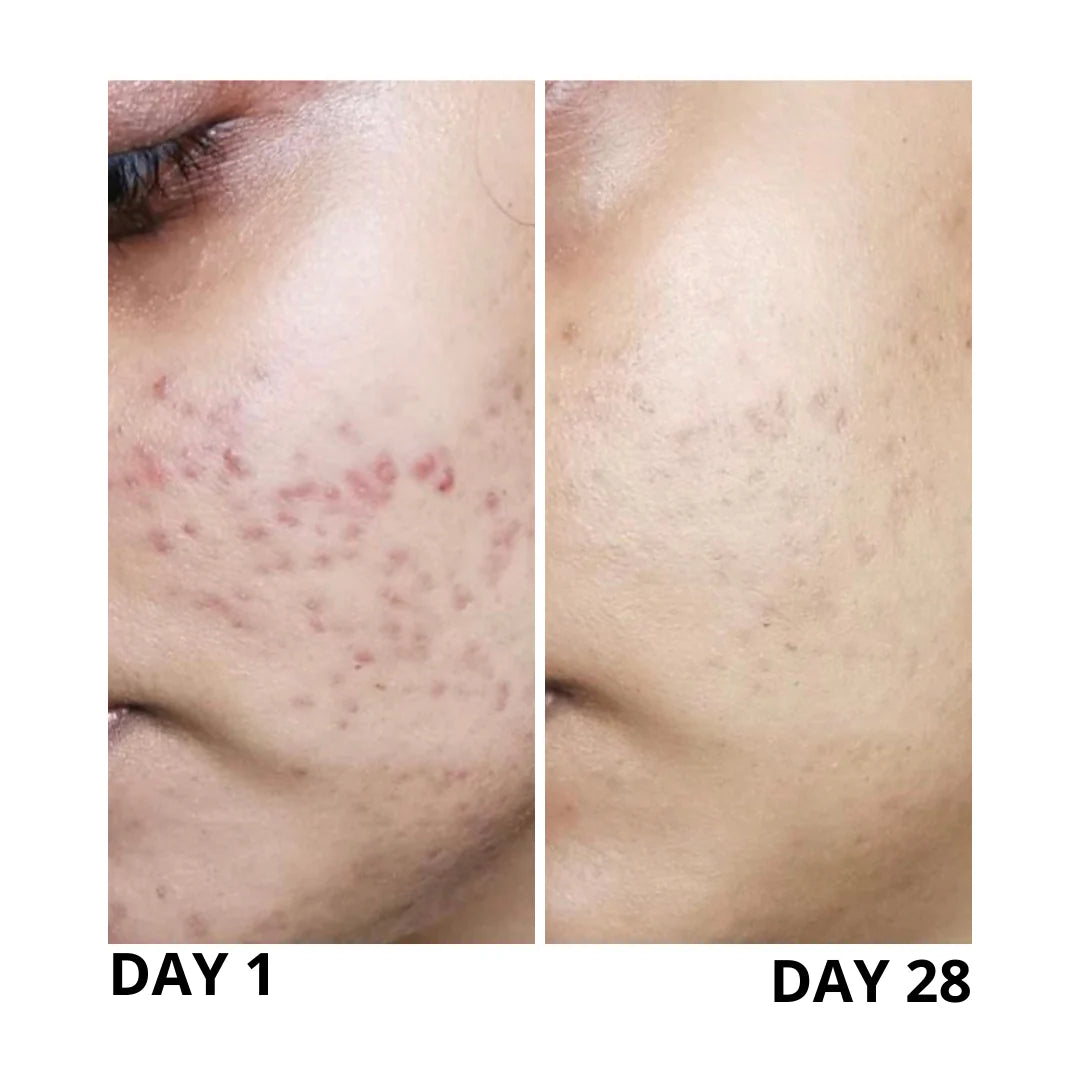 Pigmentation Corrector Serum