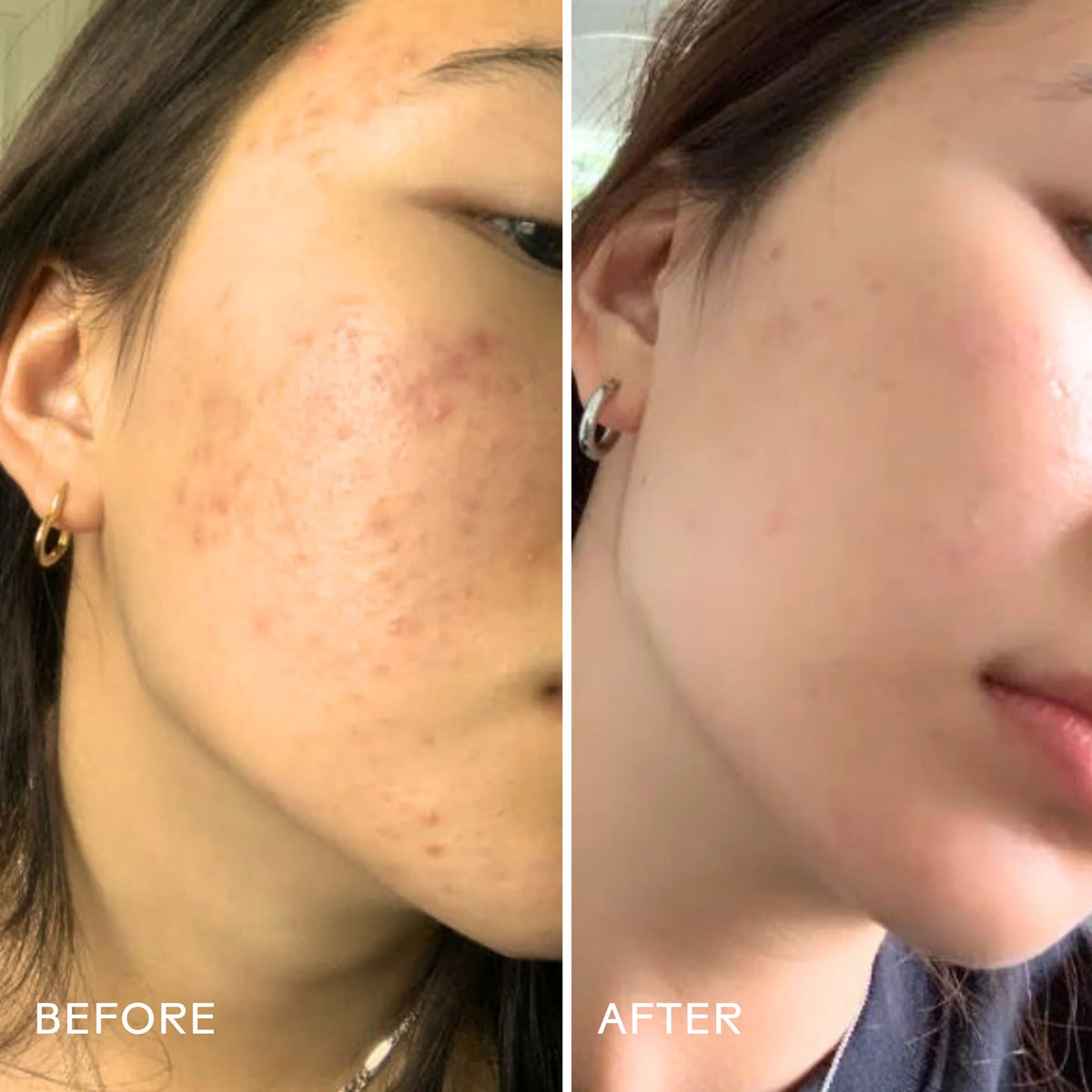 Purify Aloe + Amino Acid Cleanser | Cleansing - Gel | LOSHEN & CREM