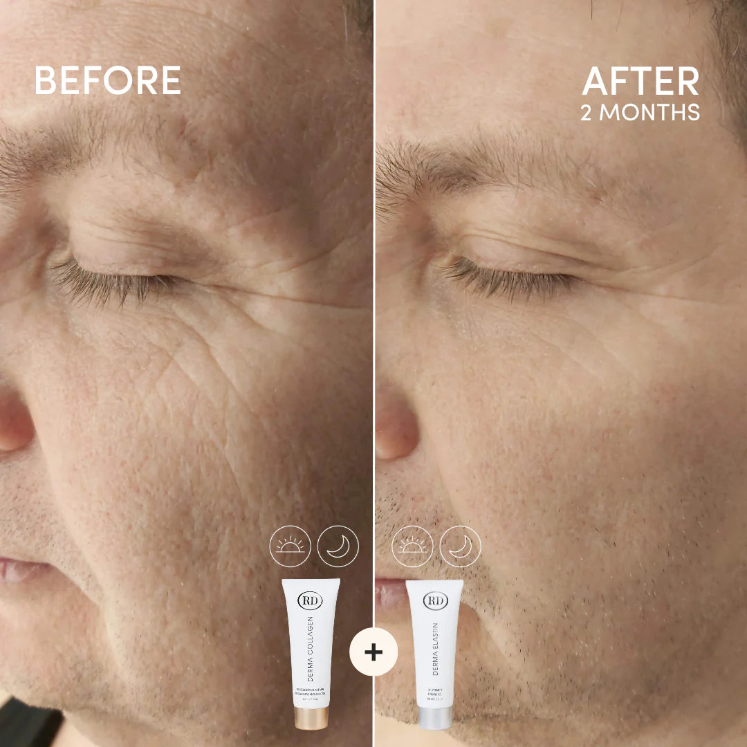 Derma Elastin™ - Firming gel | Gel - Lifting | Firming | LOSHEN & CREM