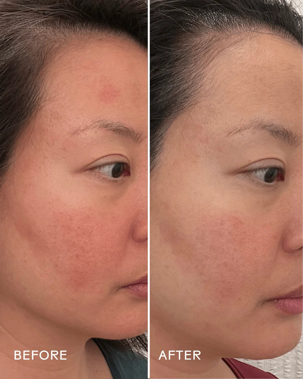 Replenish Ceramides + Blueberry Barrier Repair Serum | Serum - Nourishing | LOSHEN & CREM