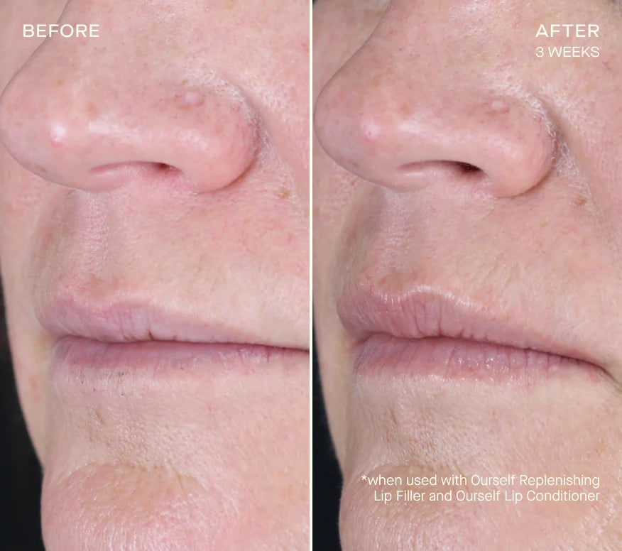 Ourself Replenishing Lip Filler after