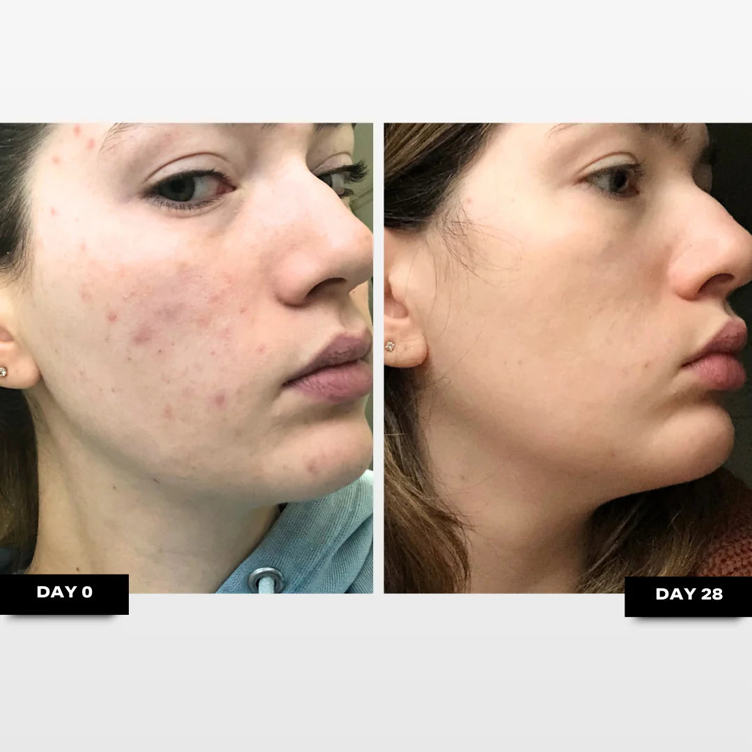 Retinal Clarity Serum