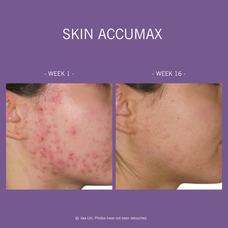 Advanced Nutrition Programme Skin Accumax™ | Supplements - Vitamins | LOSHEN & CREM