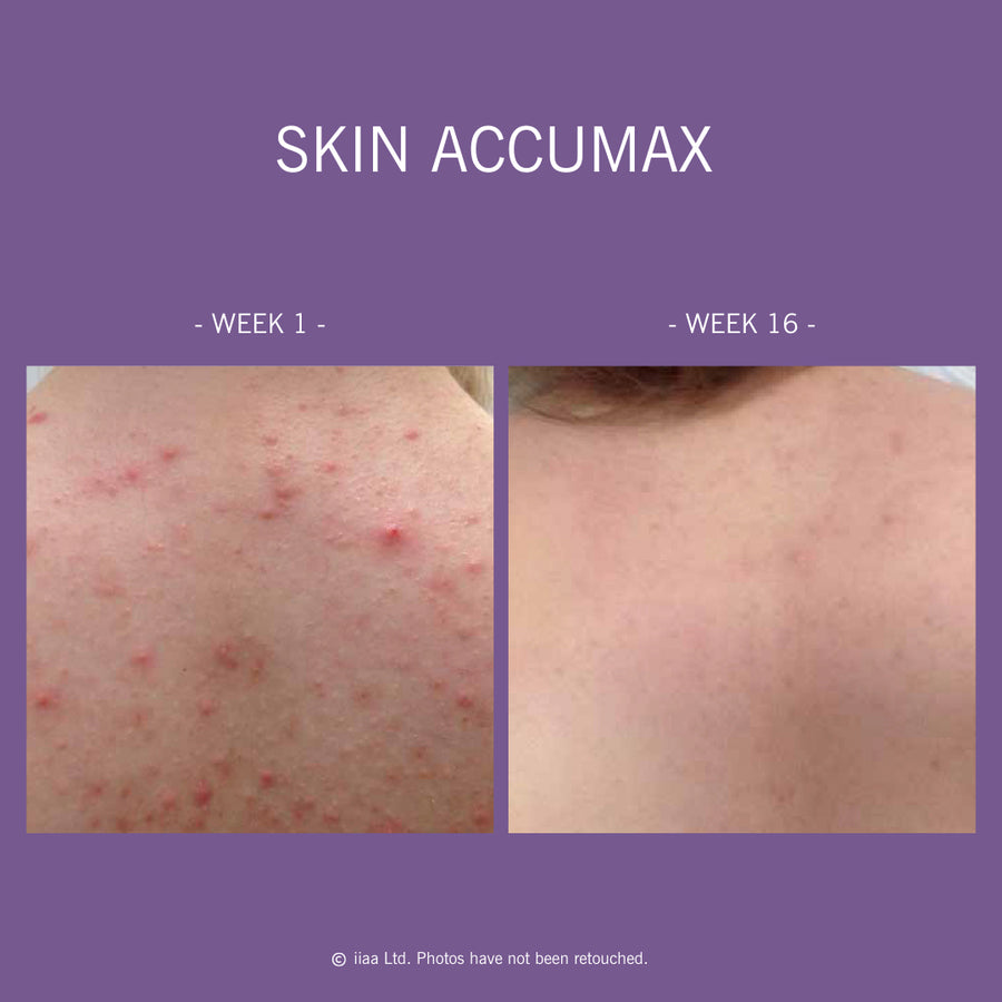 Advanced Nutrition Programme Skin Accumax™ | Supplements - Vitamins | LOSHEN & CREM