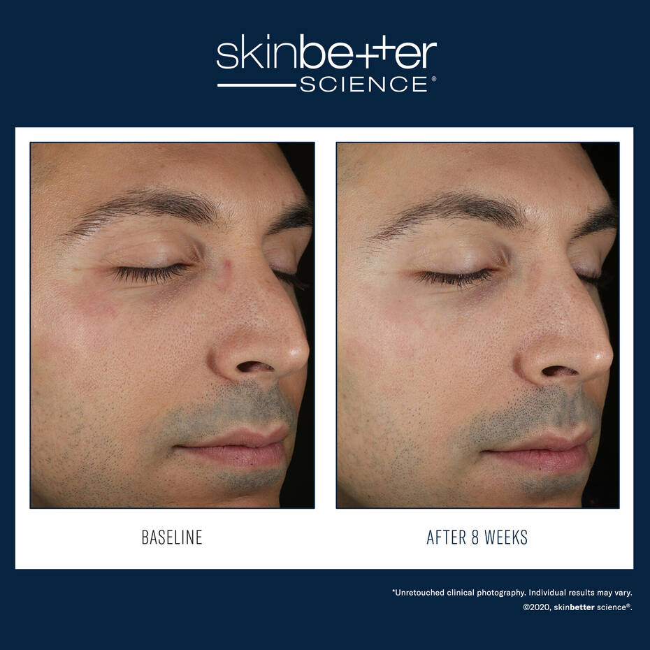 SkinBetter Science Solo Hydrating Defense - Men | Men face cream | LOSHEN & CREM