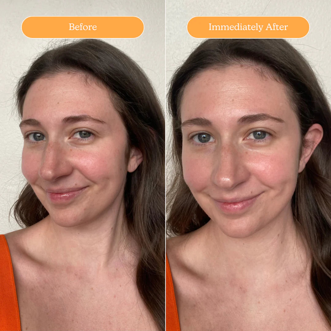 Blume Sunburst Mineral SPF 50 Sunscreen