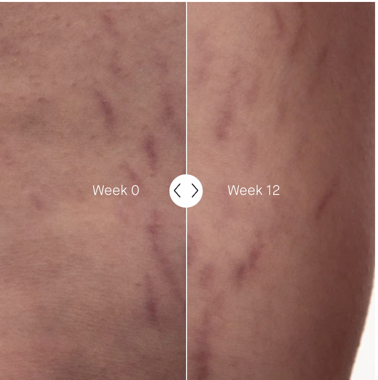 The Geranium Rose Body Cream | Body - Stretch marks | LOSHEN & CREM