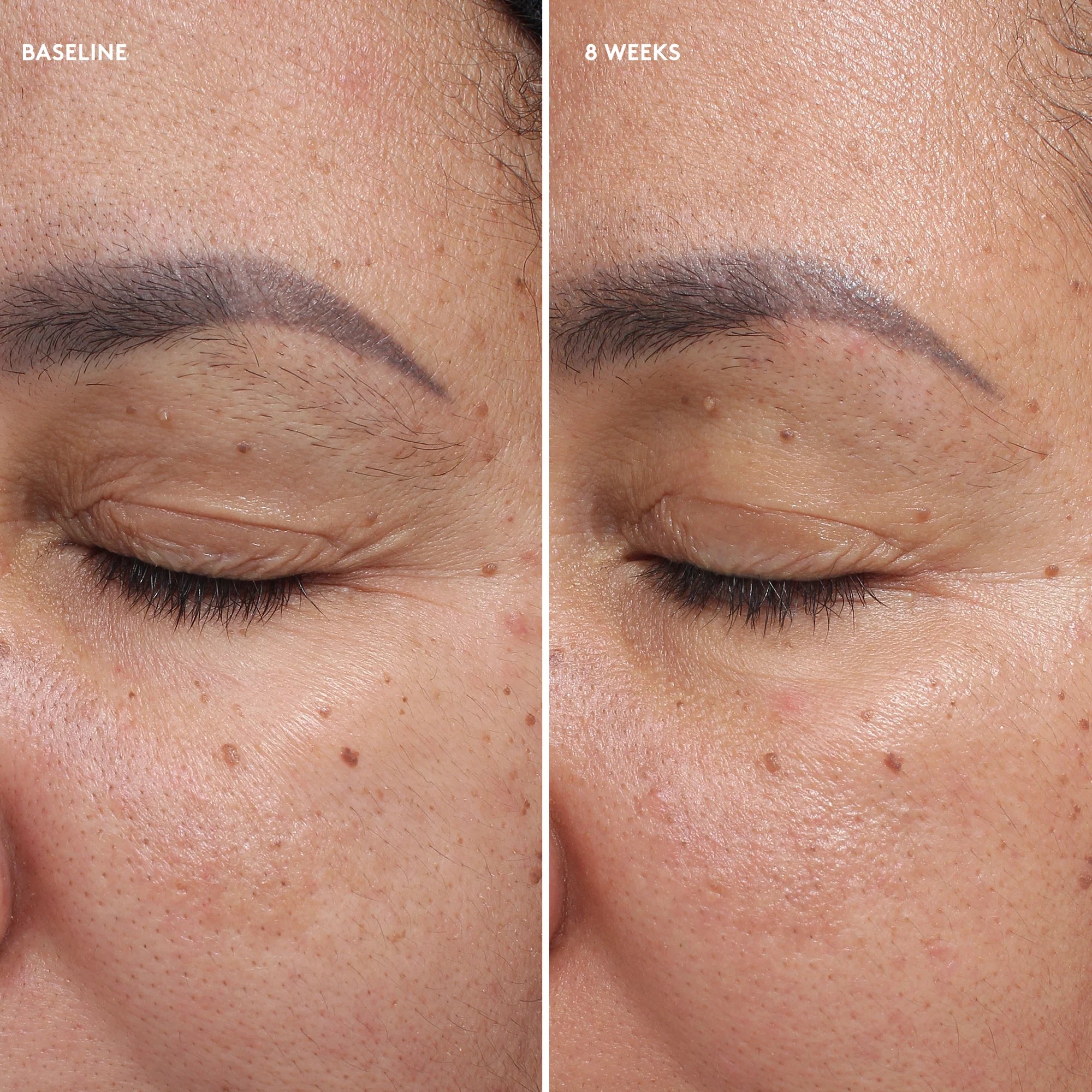 Total Eye® Firm & Repair Cream | Eye - Lifting | Firming | LOSHEN & CREM