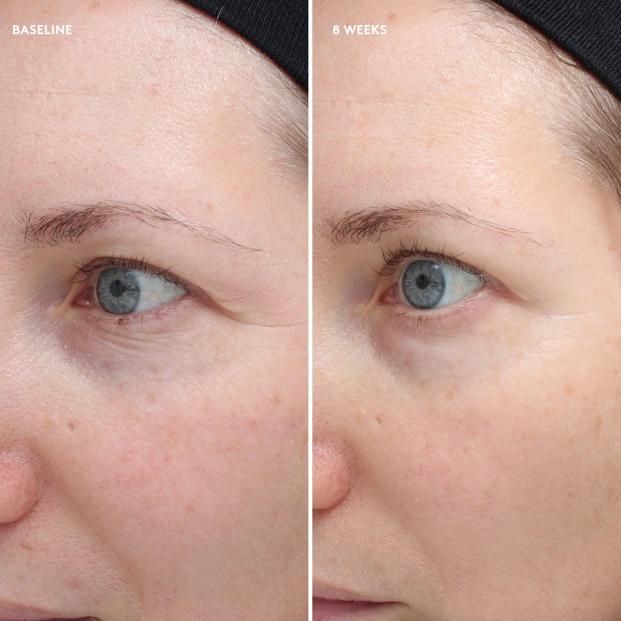 Total Eye® Firm & Repair Cream | Eye - Lifting | Firming | LOSHEN & CREM