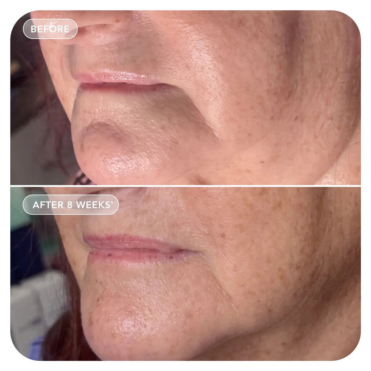 VOL.U.LIFT™ GLP-1 4D Skin Rebound Complex | Cream - GLP-1 | LOSHEN & CREM