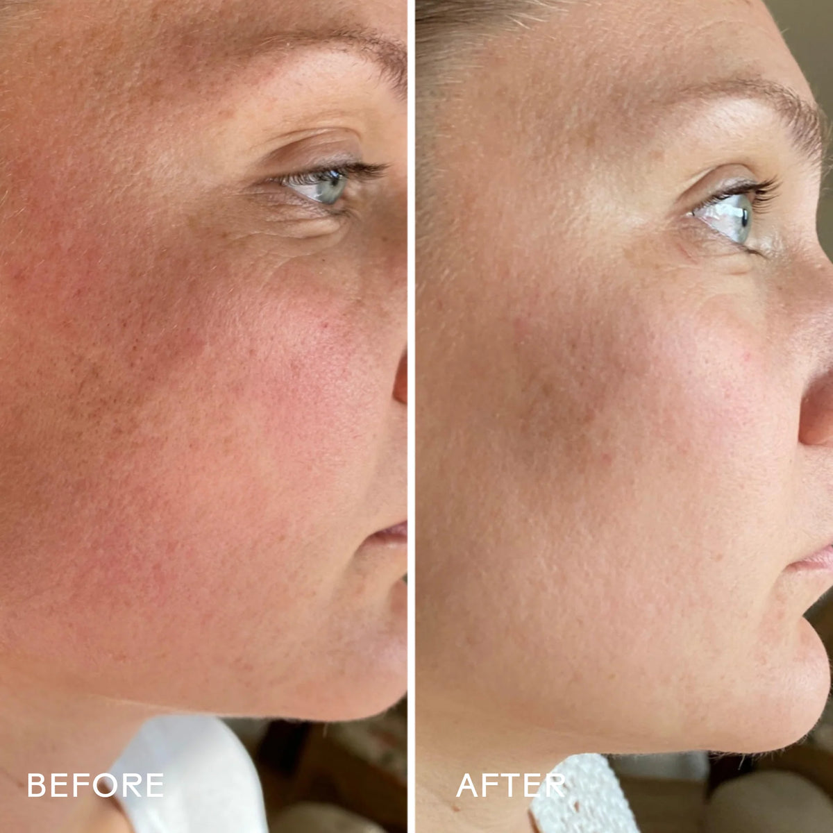 SkinHero™ Calendula + 2% Bakuchiol Bio-Retinol Serum | Serum - Bakuchiol | LOSHEN & CREM