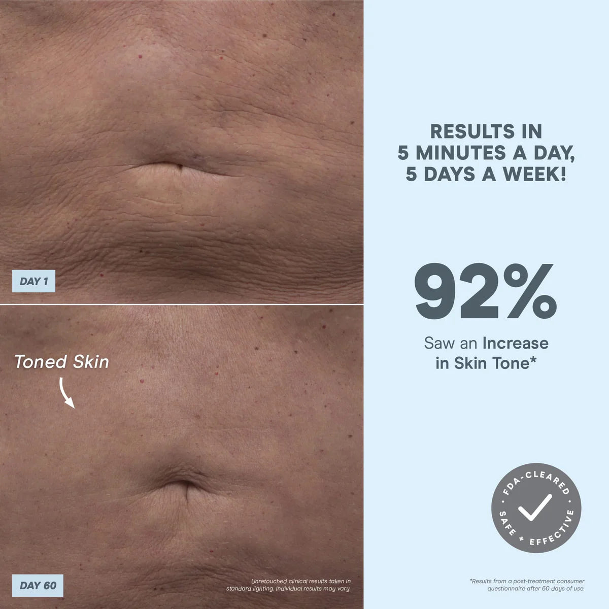NuBODY® microcurrent skin toning device for body