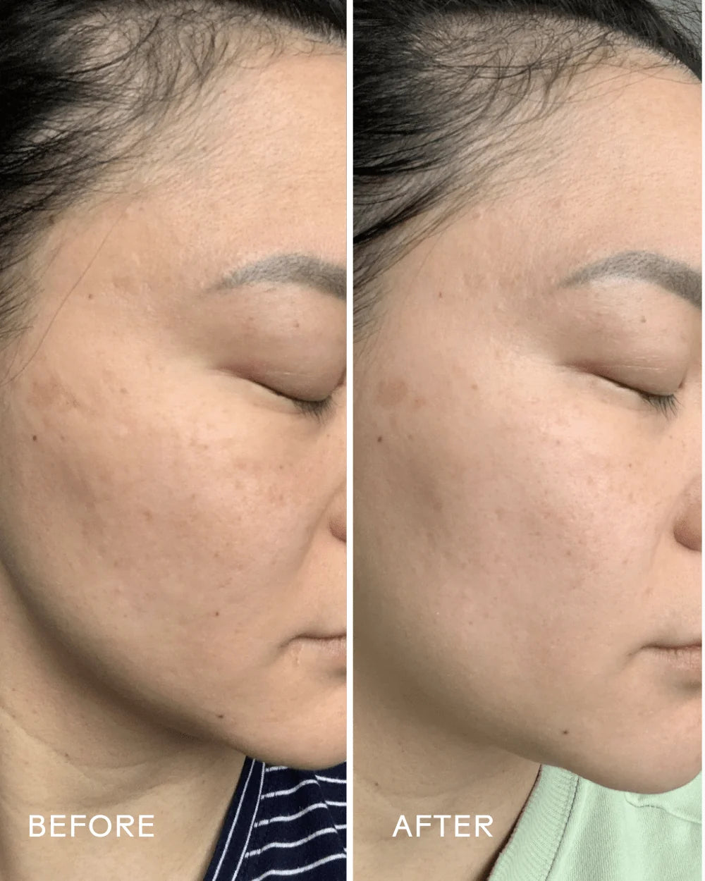 Radiance Grape Stem Cell + Squalane Day Cream | Cream - Hydrating | LOSHEN & CREM