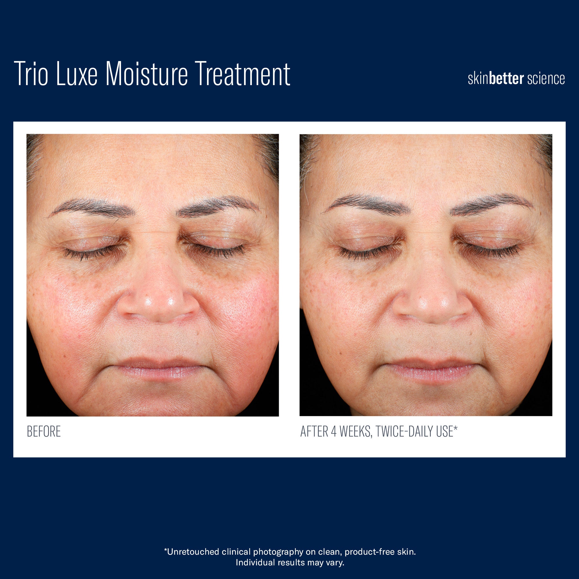 Trio Luxe Moisture Treatment | Cream - Healthy Aging | LOSHEN & CREM