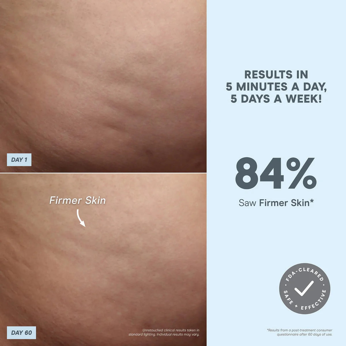 NuBODY® microcurrent skin toning device for body